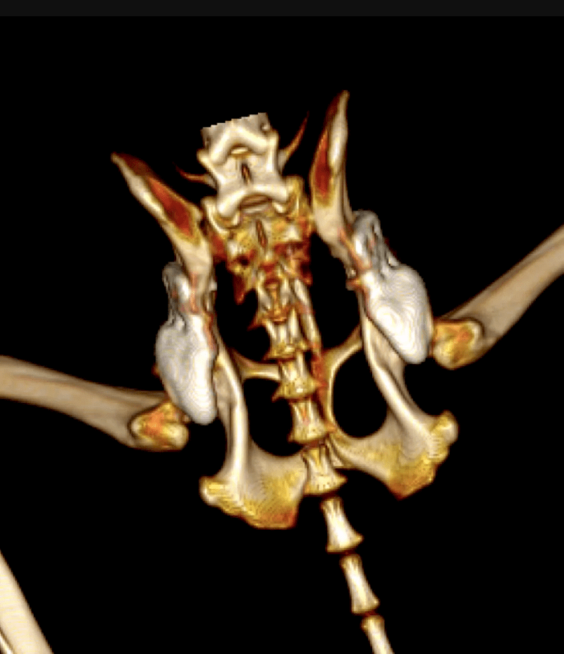 CT-scan postoperatief
